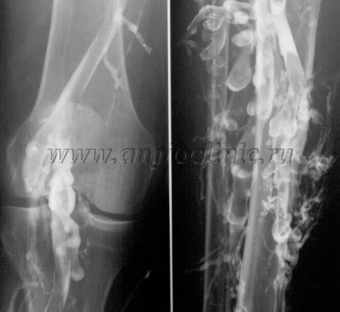 Ultrazvukové skenovanie